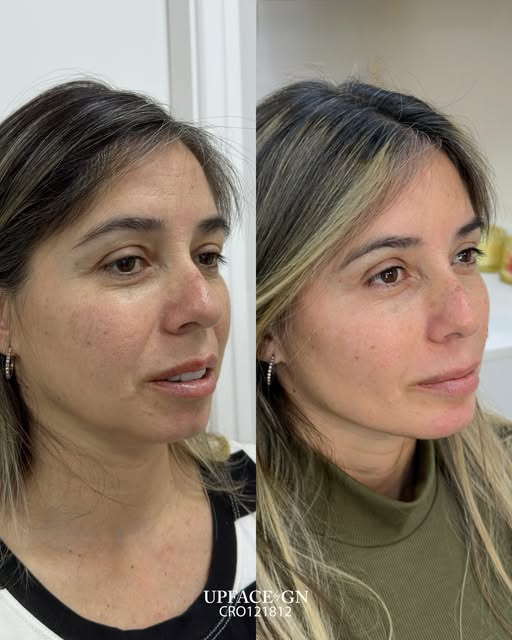 Tratamento Personalizado